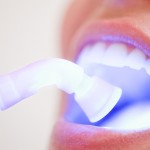 Odontologia estética, como ficar com o sorriso perfeito